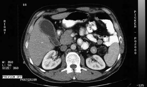 Estudio de tomografía visualizado en el visor DICOM